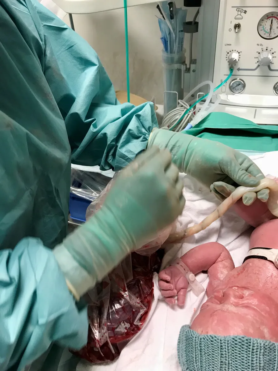En person i kirurgisk skrubb som holder en baby i en sykehusseng